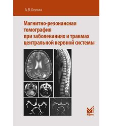 Магнитно-резонансная томография при заболеваниях и травмах центральной нервной систем..