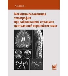 Магнитно-резонансная томография при заболеваниях и травмах центральной нервной системы