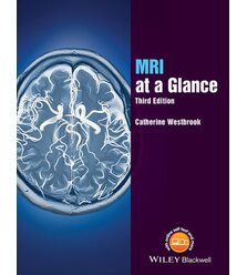 Наочна магнітно-резонансна томографія (MRI at a Glance)