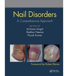 Nail Disorders. A Comprehensive Approach