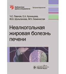 Неалкогольная жировая болезнь печени
