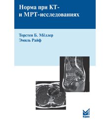 Норма при КТ- и МРТ- исследованиях