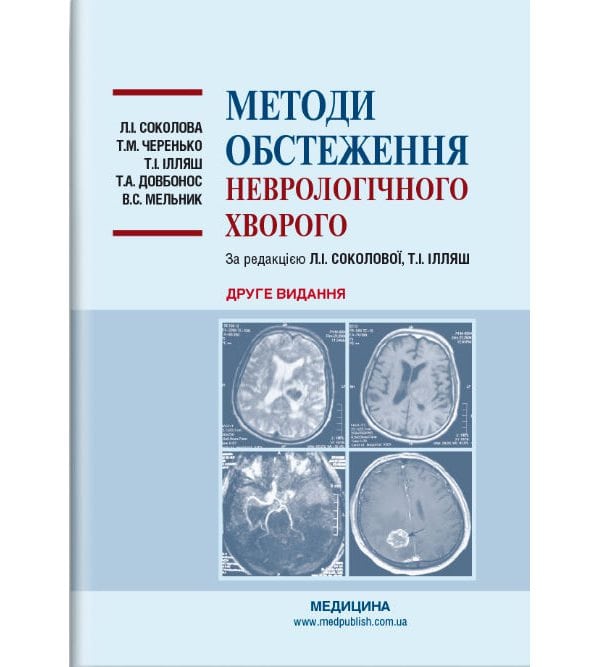 Методи обстеження неврологічного хворого