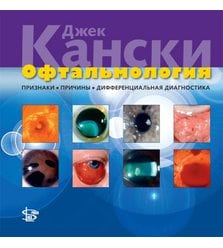 Офтальмология: признаки, причины, дифференциальная диагностика