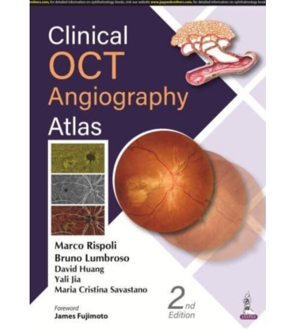 Clinical OCT Angiography Atlas - ОКТ-ангиография. Клинический атлас