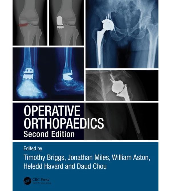 Operative Orthopaedics