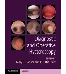 Diagnostic and Operative Hysteroscopy (Диагностическая и оперативная гистероскопия)