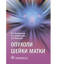 Опухоли шейки матки