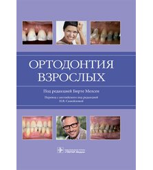 Ортодонтия взрослых 