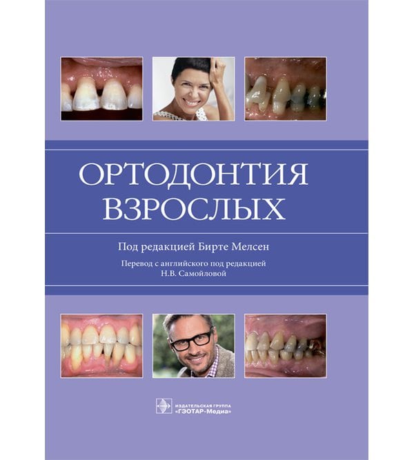 Ортодонтия взрослых 