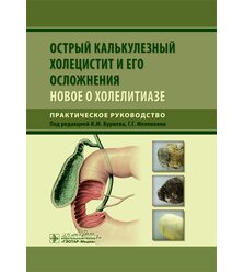 Острый калькулезный холецистит и его осложнения. Новое о холелитиазе