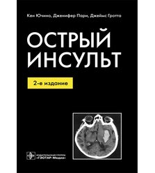 Острый инсульт