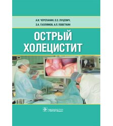 Острый холецистит 