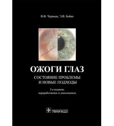 Ожоги глаз. Состояние проблемы и новые подходы