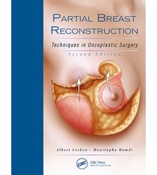Реконструкція молочної залози: техніки онкопластичної хірургії (Partial Breast Recons..