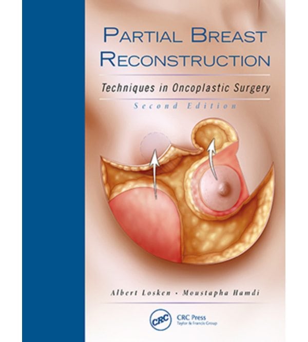 Реконструкція молочної залози: техніки онкопластичної хірургії (Partial Breast Reconstruction: Techniques in Oncoplastic Surgery)