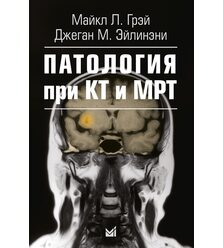Патология при КТ и МРТ