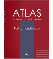 Патоморфологія. Pathomorphology: атлас укр. та англ. мовами