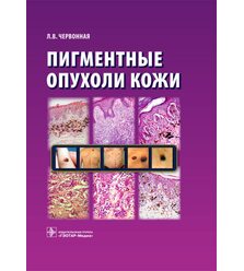 Пигментные опухоли кожи 