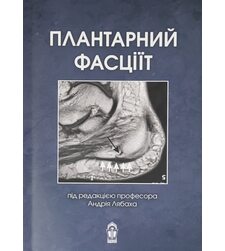 Плантарний фасціїт