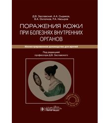 Поражения кожи при болезнях внутренних органов 