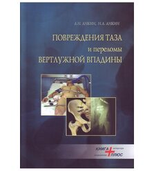 Повреждения таза и переломы вертлужной впадины