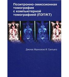 Позитронно-эмиссионная томография с компьютерной томографией