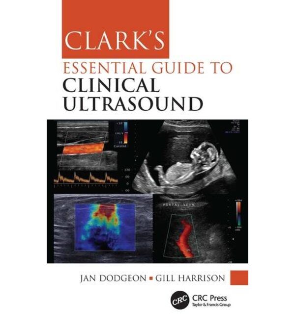 Clark's Essential Guide to Clinical Ultrasound (Практичне керівництво з УЗД)