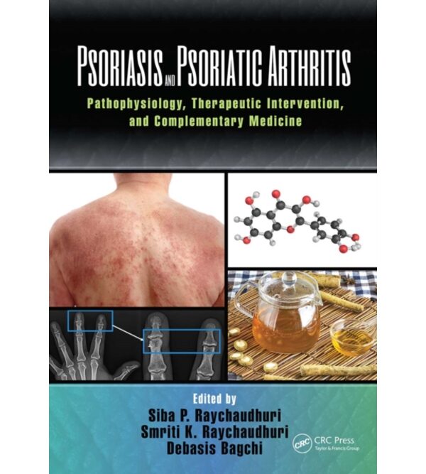 Псоріаз і псоріатичний артрит: патофізіологія, терапія (Psoriasis and Psoriatic Arthritis)