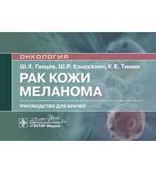 Рак кожи. Меланома: руководство для врачей