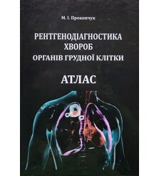 Рентгенодіагностика хвороб органів грудної клітки