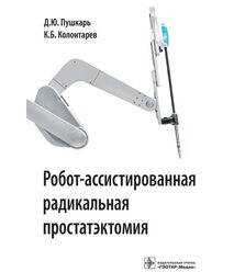 Робот-ассистированная радикальная простатэктомия 