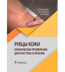 Рубцы кожи. Клинические проявления, диагностика и лечение