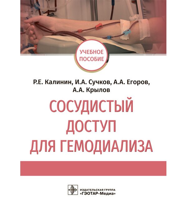 Сосудистый доступ для гемодиализа