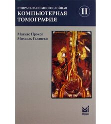 Спиральная и многослойная компьютерная томография Т.2