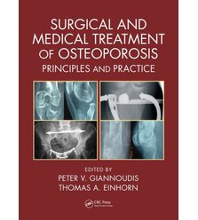 Surgical and Medical Treatment of Osteoporosis