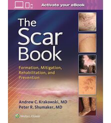 Шрамы (The Scar Book)