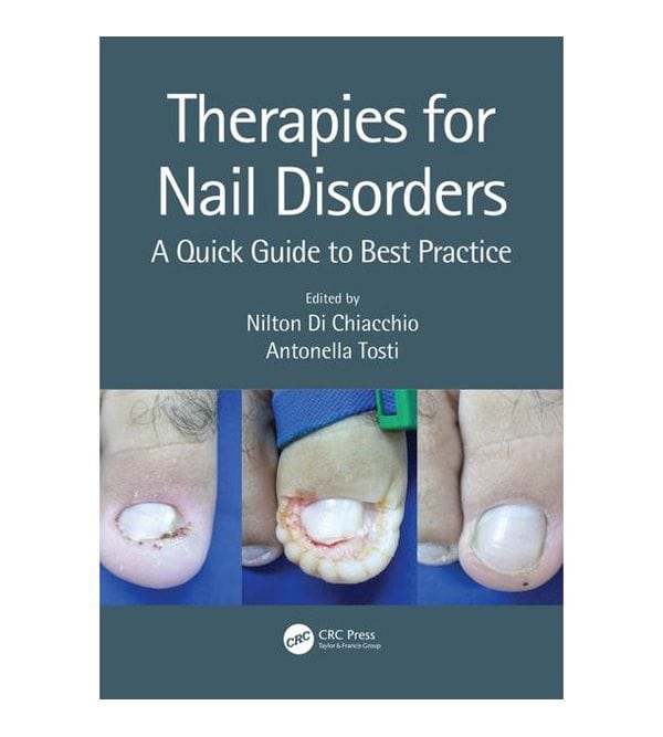 Therapies for Nail Disorders (Лікування хвороб нігтів)