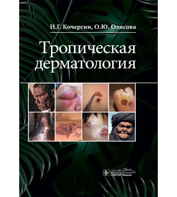 Тропическая дерматология