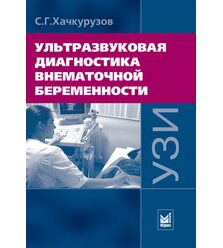 Ультразвуковая диагностика внематочной беременности