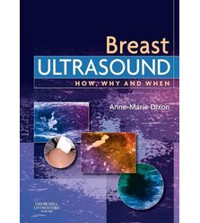 Ультразвукове дослідження молочних залоз (Breast Ultrasound)