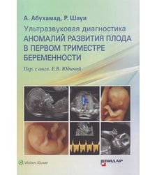 Ультразвуковая диагностика аномалий развития плода в первом триместре беременности