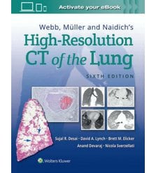 КТВР Легенів (Webb, Müller and Naidich's High-Resolution CT of the Lung)