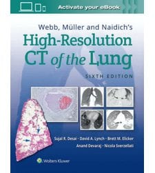 КТВР Легких (Webb, Müller and Naidich's High-Resolution CT of the Lung)