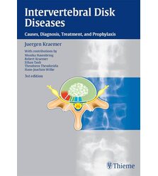 Захворювання міжхребцевих дисків (Intervertebral Disk Diseases)