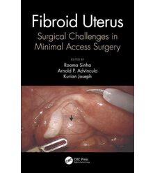 Міома матки. Мінімально інвазивні хірургічні техніки