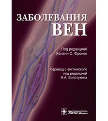 Заболевания вен